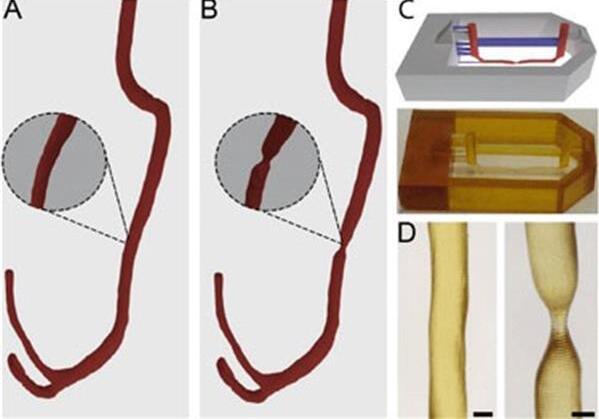 微流控管模仿血管通道