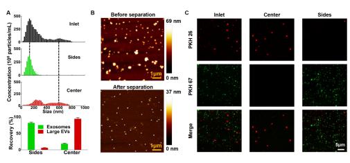 外泌體分離前后的表征