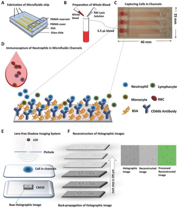 監(jiān)控血液中嗜中性粒細(xì)胞數(shù)量的新方法