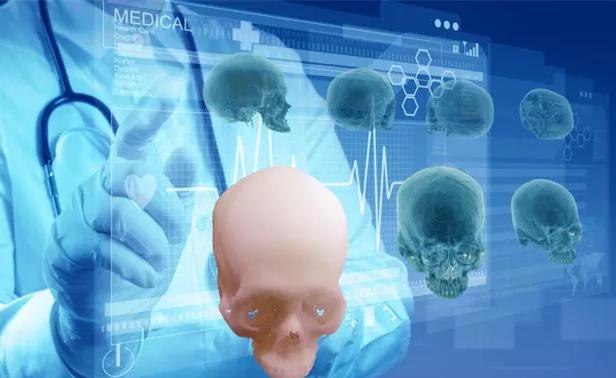 3D打印在面頜修復中的應用