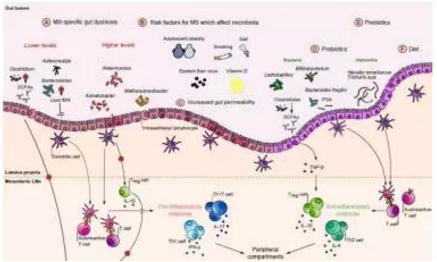 腸道菌群在多發(fā)性硬化中的作用