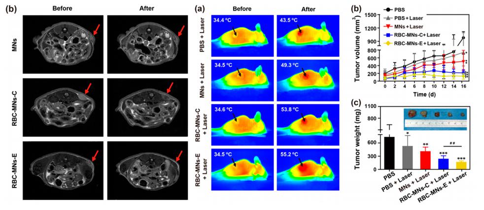 電穿孔包膜技術(shù)應(yīng)用于腫瘤MRI成像與光熱治療