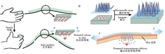 圖2可穿戴式微流控藥物釋放裝置。(A)內置藥物的可穿戴式微流控芯片,通過手指的彎曲完成藥物釋放(B)內置藥物的可穿戴芯片與微針陣列結合