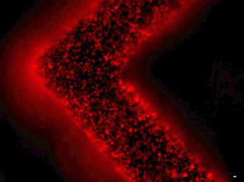 細胞外囊泡（紅色）從患者腫瘤細胞中釋放并被捕獲在EV-HB芯片表面。