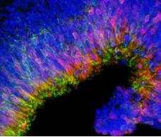 由3D細胞培養產生的新生視網膜