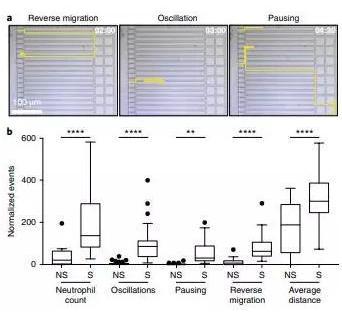 敗血癥特異性的中性粒細(xì)胞自發(fā)的遷移模式。