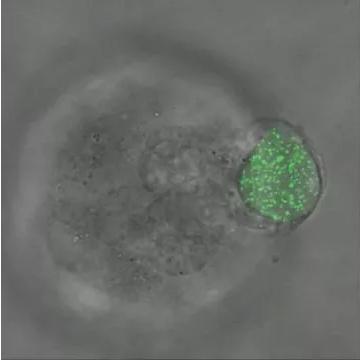 華中科大研發(fā)出測量三維生物力的新技術(shù)，有望用于癌癥早期診斷