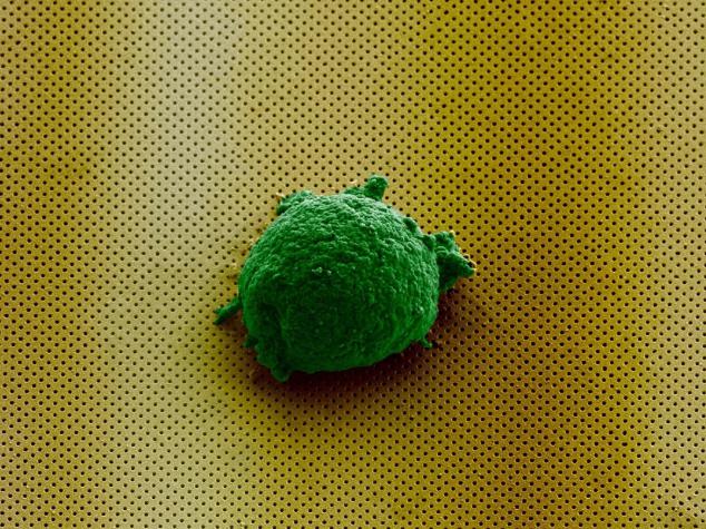 《Small》雜志封面圖片顯示，單個淋巴瘤細胞孤獨地存在于新型生物傳感器上。