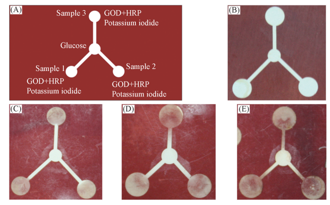 Fig.3Schematicpatternsofmicrochannelsusedforglucoseassays(A),blankexperiment(B)andthechangedcolorofiodinewith10郾0mmol/L(C),25郾0mmol/L(D),50郾0mmol/L(E)ofglucose