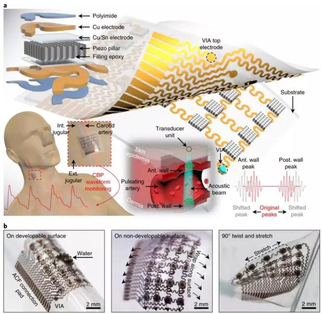 可實時監測體內深處動脈血壓的柔性超聲波貼片