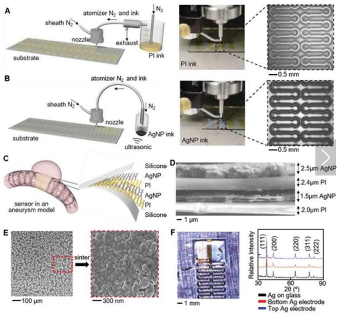 可拉伸的無線傳感器可以監測腦動脈瘤的愈合